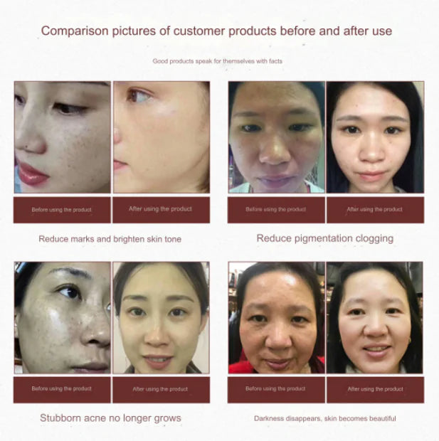 Herbal Mask Powder for Brightening Skin Tone