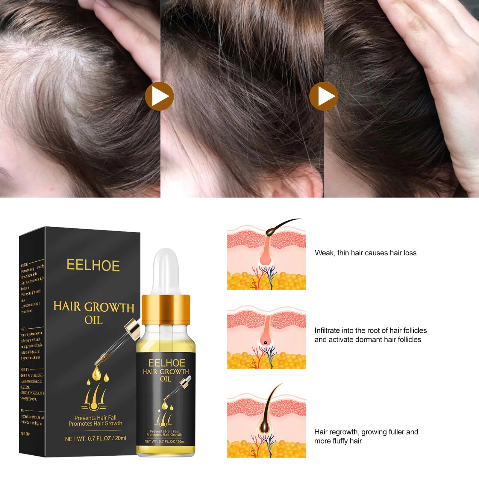 LAVDIK Hair Growth Serum Oil for Cross-Border Care